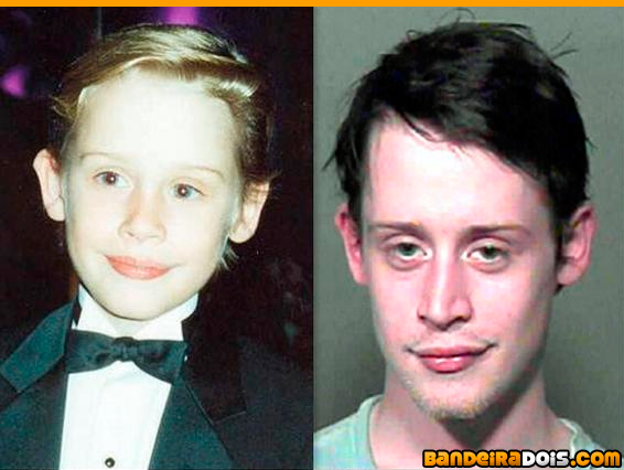 Antes e depois de algumas celebridades