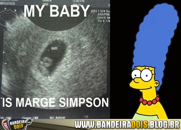 Marge Simpson aparece em Ultrassom