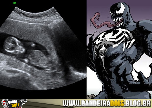 Até Venom parece estar 'dentro' de barriga de futura mãe